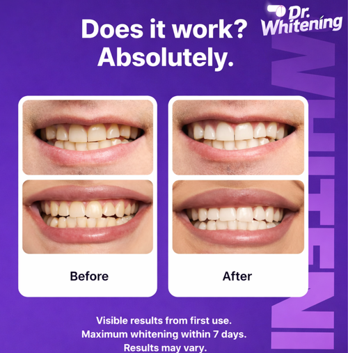Dr. Whitening Purple Strips